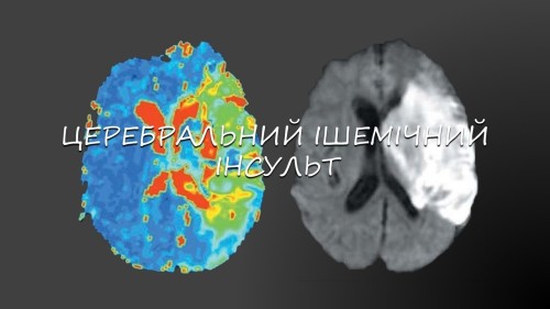 Відіотека.
